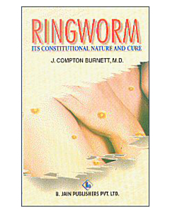 Ringworm
